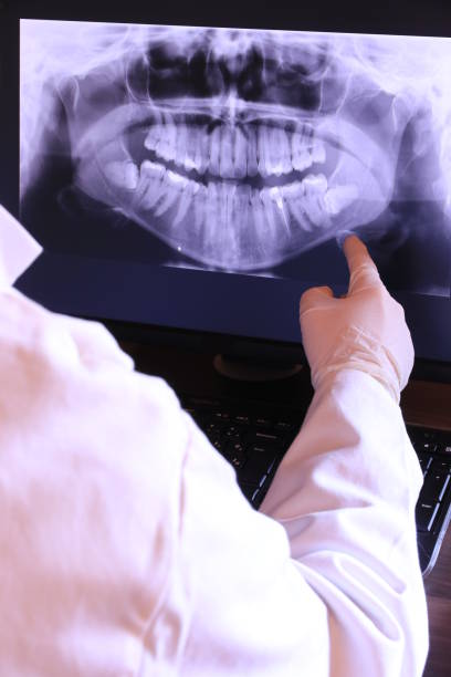 Best Emergency Tooth Extraction in Evansdale, IA